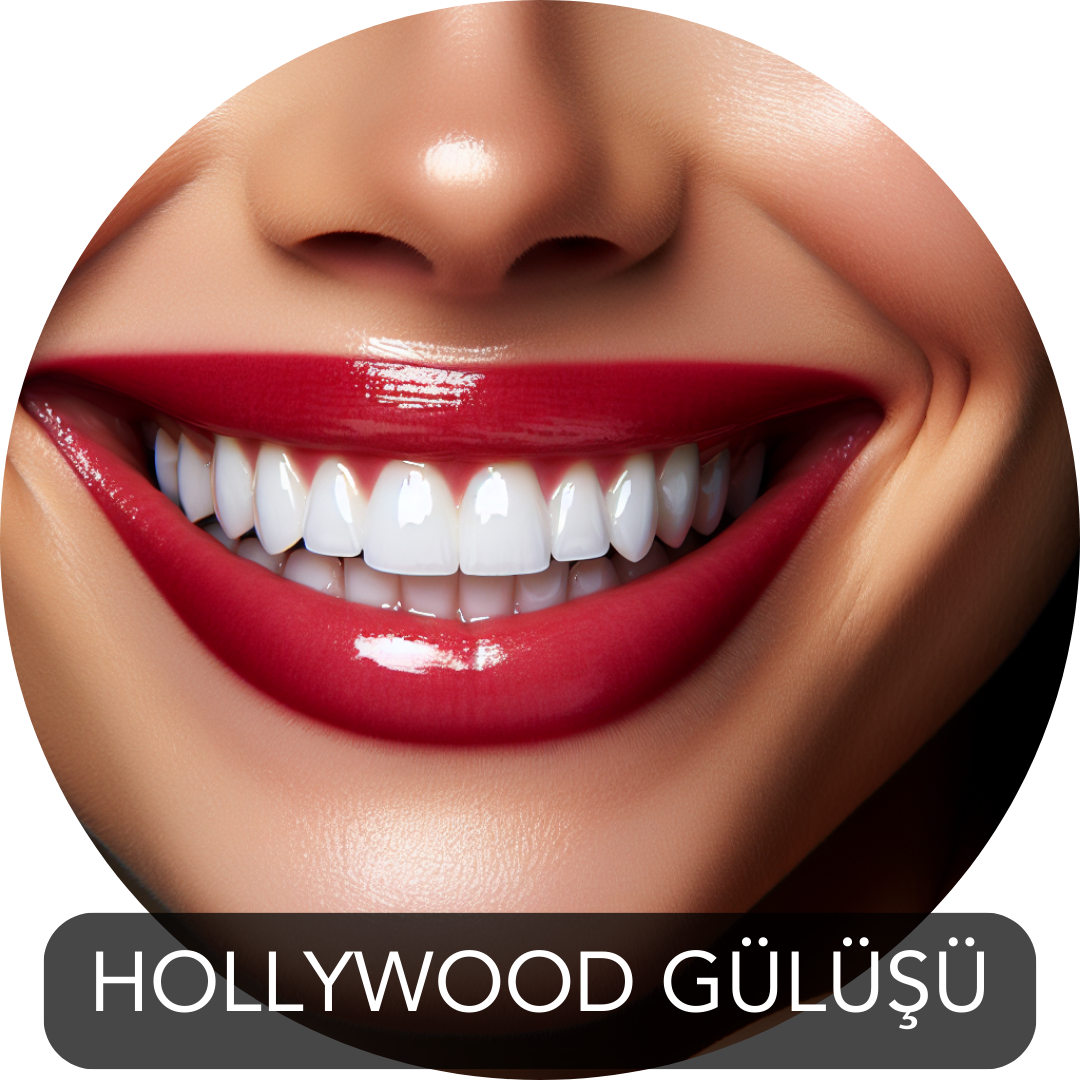 Hollywood smile