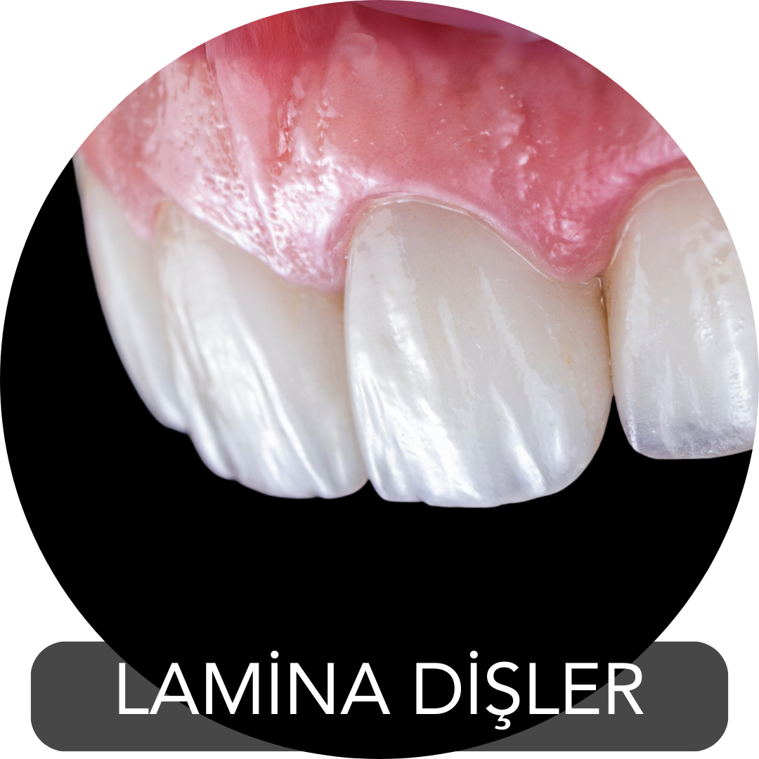 Lamina diş
